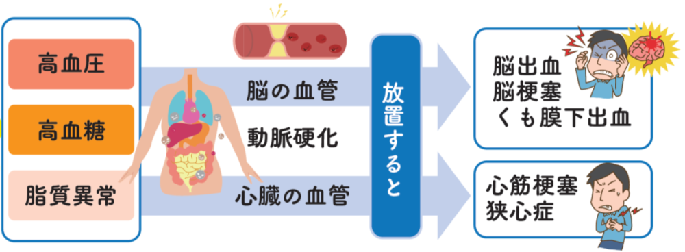 健康リスク因子から重大な疾病へ