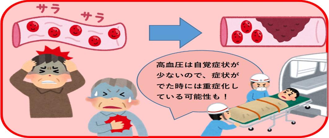 リスク