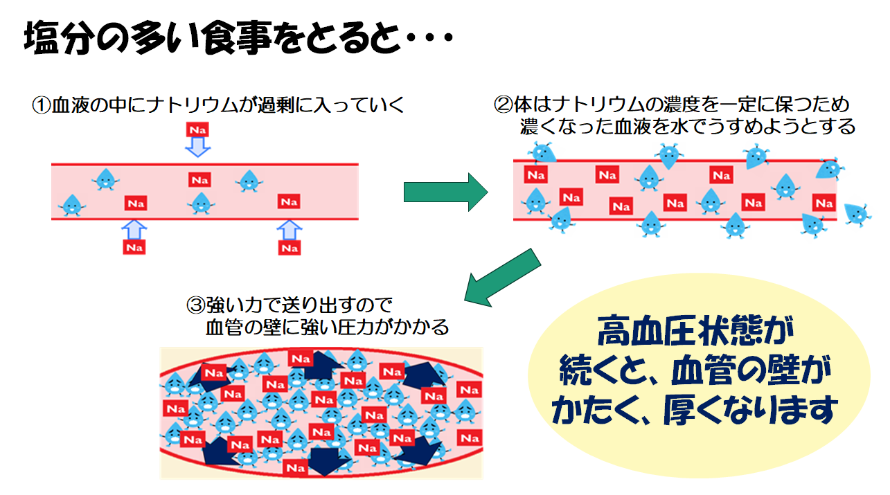 塩分の多い食事をとると高血圧に
